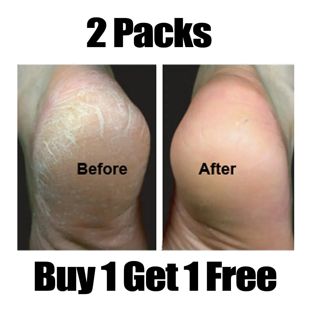 2 Pair Moisturizing Socks Foot Spa Home Treatment Aloe Skin Moisture Dry Feet !!