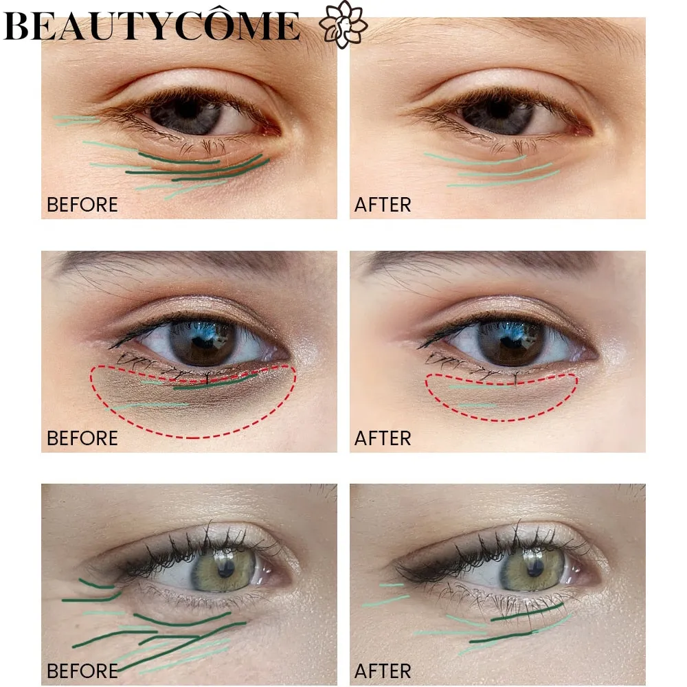 BEAUTYCOME Retinol Face Eye Cream Serum 4PCS/Set Firming Lifting Anti-Aging Reduce Wrinkle Fine Lines Facial Skin Care Suit